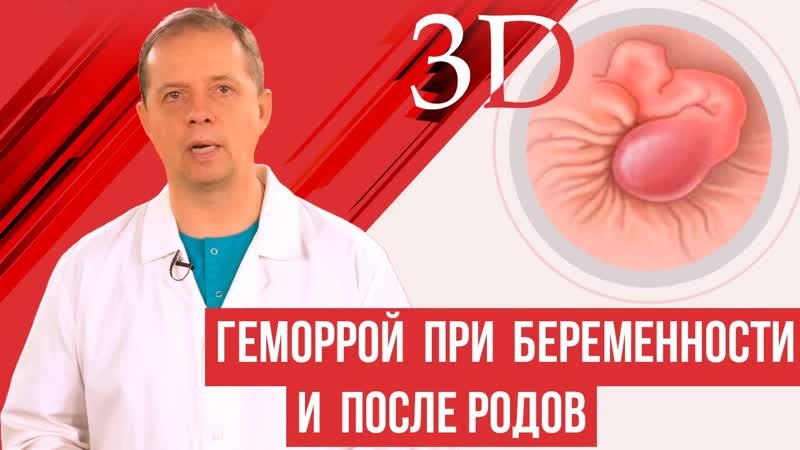 Геморрой при беременности и после