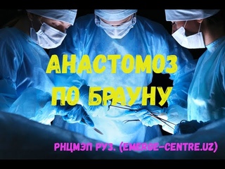 Наложение межкишечного анастомоза по Брауну. Учебный материал РНЦЭМП РУз (2011 год).