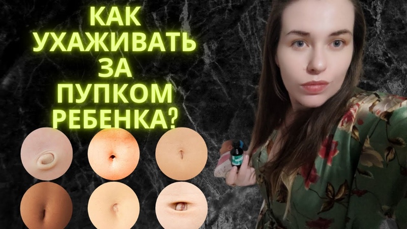 КАК ухаживать за ПУПКОМ новорожденного РЕБЕНКА Узнай