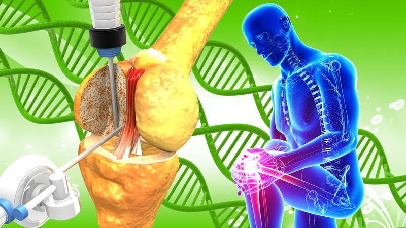 CURE CHRONIC ARTHRITIS Repair All Nerves and Veins Of The Body, Clear Bad Energies Foot Massages,