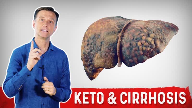 Can Keto ( Ketogenic Diet) Help Cirrhosis of the