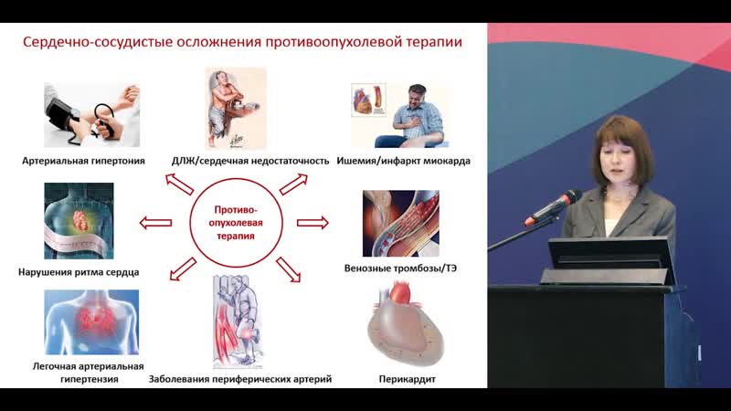 Сердечно сосудистые осложнения противоопухолевой терапии: