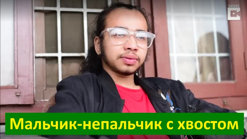 2364 Подросток из Непала отрастил 70 см хвост и решил не