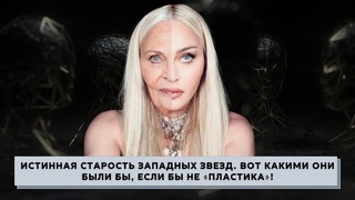 ИСТИННАЯ СТАРОСТЬ западных ЗВЕЗД. Вот какими они были бы, ЕСЛИ БЫ не пластика!
