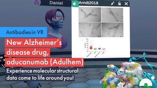 Antibodies in VR: New Alzheimer’s disease drug, aducanumab (Adulhem), bound to beta amyloid plaque