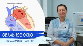ОТКРЫТОЕ ОВАЛЬНОЕ ОКНО | Норма или патология