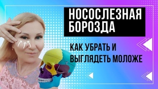 Носослезная Борозда: Как Убрать И Выглядеть Моложе