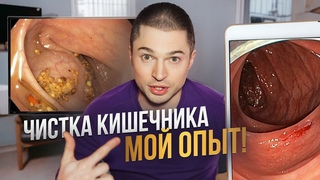 ИЗ МЕНЯ ВЫШЛО 11 КГ КАЛА / ПОХУДЕЛ НА 8 кг и открыл для себя новый бизнес