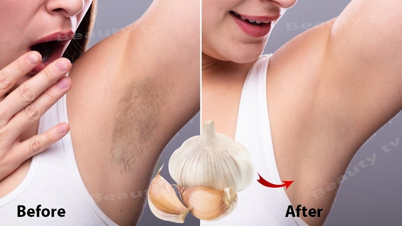 stop shaving heres how to permanently get rid of facial, body and pubic