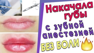 Увеличение губ гиалуроновой кислотой. Мой опыт с зубной анестезией. Исправление асимметрии губ.