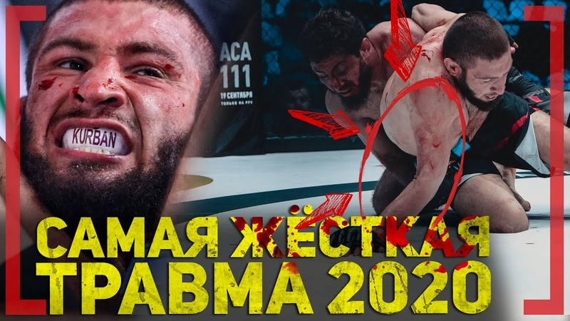 САМАЯ ЖЁСТКАЯ ТРАВМА 2020 Курбан Тайгибов БОЕЦ с ОГРОМНЫМ