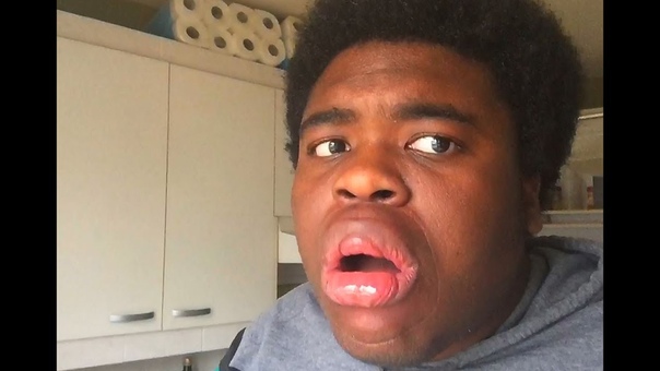 Kylie Jenner lip challenge SHOT GLASS CHALLENGE Gone So Wrong