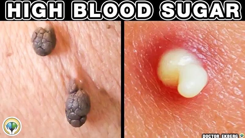 10 Alarming Skin Signs of