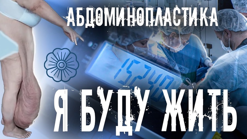 АБДОМИНОПЛАСТИКА. ХОЧУ