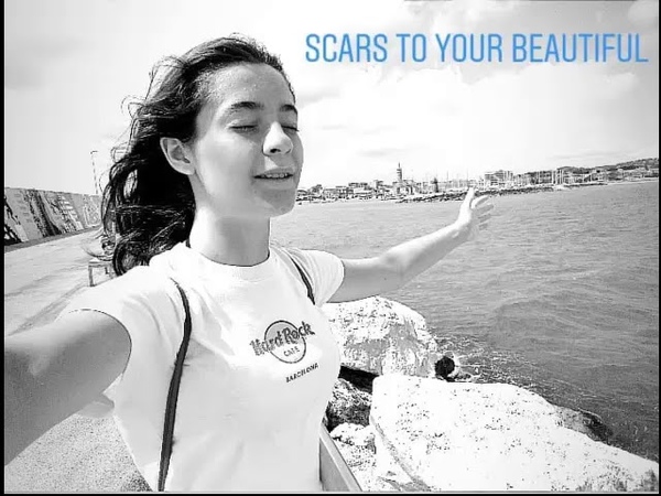 Sofia Tornambene Scars to Your Beautiful ( Cover Alessia