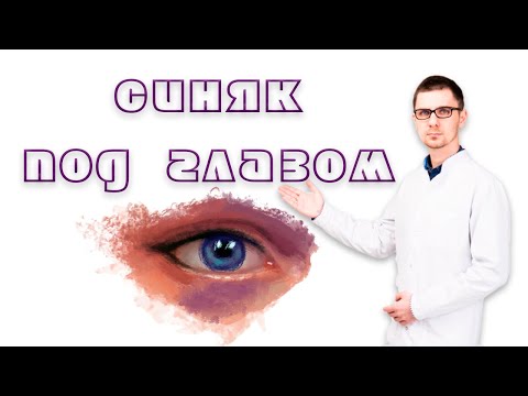 Синяк под глазом от