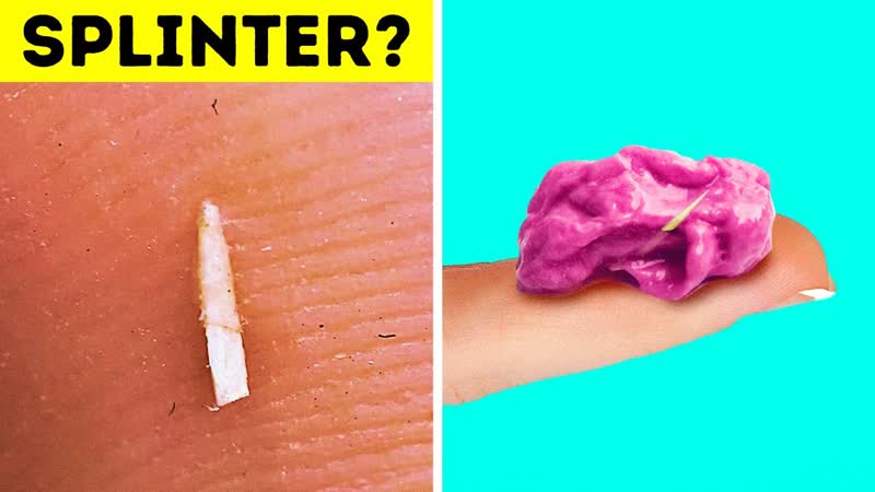 19 EMERGENCY HACKS EVERYBODY SHOULD