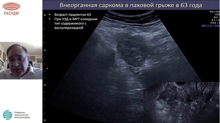 Ультразвуковая диагностика экстрагенитальной патологии малого таза