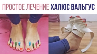Халюс Вальгус – Лечение без операций в домашних условиях!