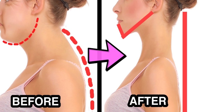 17mins Fix Neck Hump Fat Lift Sagging Jowls, Get Slim Long Neck, Look Younger With This